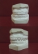 Fara extractie dentara, prin combinarea unei gutiere miofunction