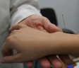 Acupunctura (2)