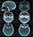 Cabinet Neurologie Dr. Paunescu Marinela Florina